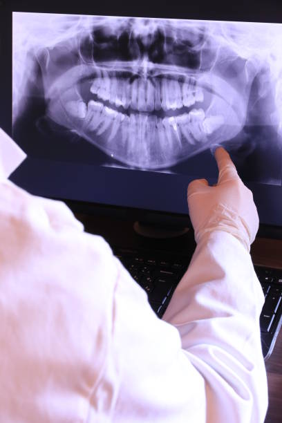 Best Emergency Root Canal Treatment in Highland, MD